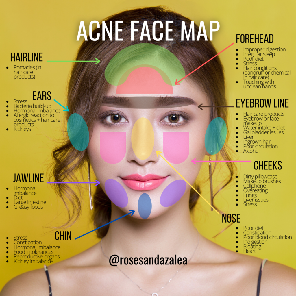 Find Out Now, What Should You Do For Fast acne?