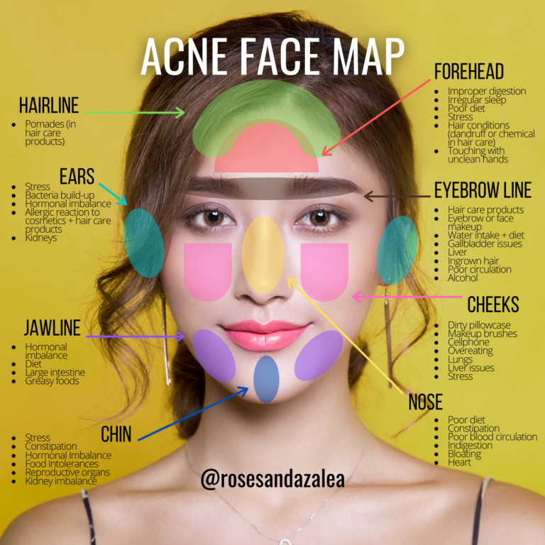 What is Your Acne Telling You? – Divine Deity Skin